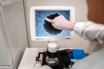 若い世代の大腸がんが増加　検診年齢の引き下げは有効か