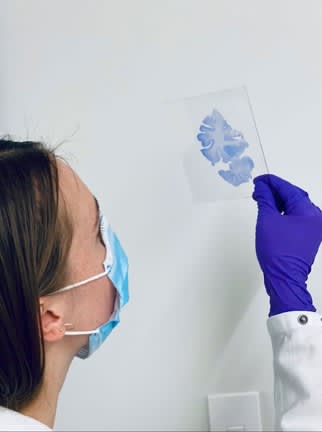 80歳なのに50歳並みの脳機能、「スーパーエイジャー」の脳が衰えない理由は？