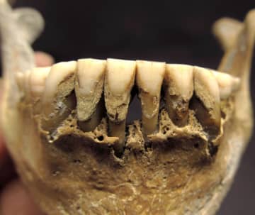 中世の人骨歯石からキビ食確認　ウクライナで出土、奈文研