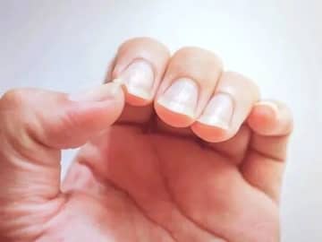 【爪診断】縦に筋がある人や、反っている人は要注意。体の隠れトラブルをチェック！