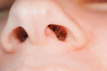 鼻毛を抜くと切る、どっちがいい？身だしなみの正解と失敗しないコツ