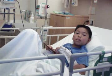 “命に関わる恐怖と共に”重度の食物アレルギーと生きる21歳　専門医が語るリスクと支援