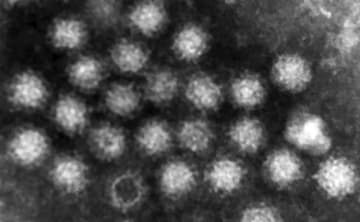 高校生ら95人食中毒　ノロ検出、営業停止