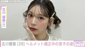 古川優香（28）「レベル3の重症」ヘルメット矯正中の息子の最新ショットを公開