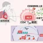 組織常在性の免疫細胞を制御して慢性炎症を発症させる“司令塔”を特定　千葉大学など