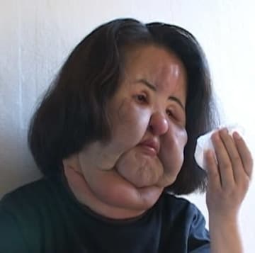 美女がなぜ“扇風機おばさん”に？死去の秘話が明かされる…違法整形、顔に工業用シリコンを注入