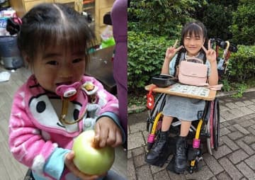 生後2日で突然の窒息。「3歳までしか生きられないかも」と医師の宣告も…その原因は「ヒルシュスプルング病類縁疾患」という難病だった【体験談】