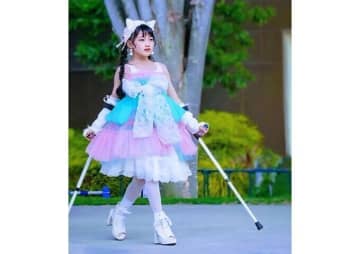 複数の病気と向き合いながらモデル活動を続ける娘…6人きょうだいの末っ子を支える家族の思いとは【ヒルシュスプルング病類縁疾患体験談】