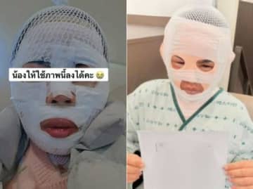 「他の男に会わないように」…タイ人の妻の顔に熱湯をかけた夫、拘束起訴＝韓国