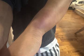 鎌倉で強盗致傷　未明の凶行…閑静な住宅街は恐怖　被害者が明かした一部始終とは