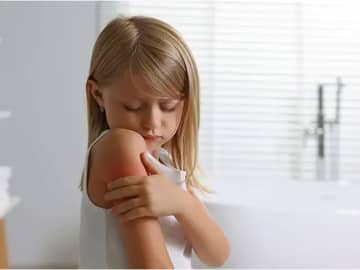 子どもが体中掻きむしっていたら。対策とセルフケアについてクリニック院長安達先生にお伺いしました