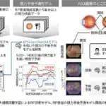千葉大学がAIを用いて網膜色素変性症を高精度診断　将来の視力低下も予測