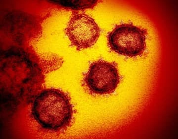 国内で新たに1671人が感染　22人死亡、新型コロナ