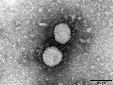 国内で1万7713人感染　死者65人、重症者は最多