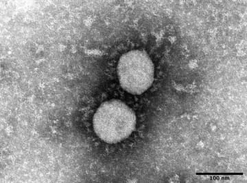 国内の感染者、累計150万人超　コロナ、1カ月弱で50万人増加