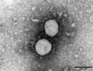国内で1576人コロナ感染　ワクチン接種は7割