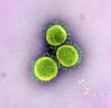 国内で287人感染、7人死亡　重症者は11人減の134人