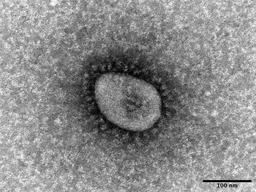 国立感染症研究所が分離した、新型コロナウイルスのオミクロン株の電子顕微鏡写真（同研究所提供）