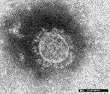 新型コロナウイルスの電子顕微鏡写真(国立感染症研究所提供)