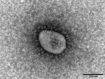 国内コロナ感染、4万9930人　死者は126人