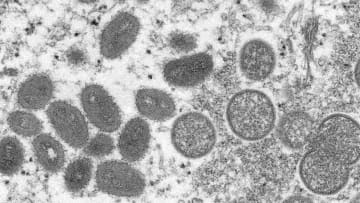 【速報】千葉県で「サル痘」感染者が判明　国内4例目　千葉県が緊急会見へ