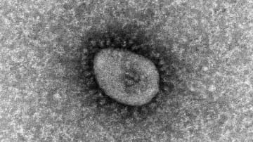 （資料写真）SARS-CoV-2 B.1.1.529（オミクロン）系統の電子顕微鏡写真(国立感染症研究所ウェブサイトから）
