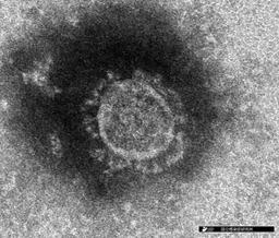 国立感染症研究所で分離された新型コロナウイルスの電子顕微鏡写真像（同研究所提供）