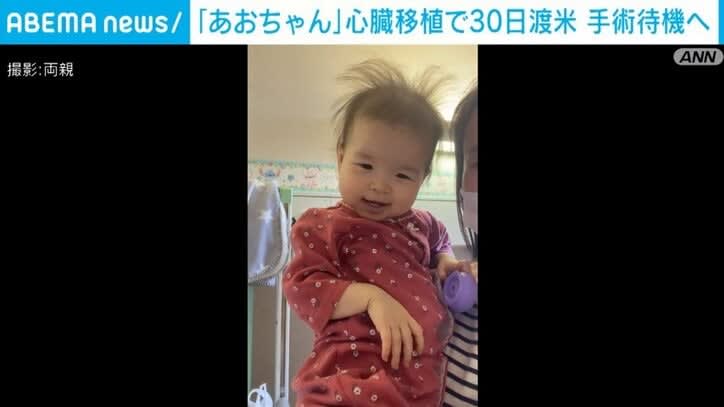 ⚡｜重症心不全を抱える1歳の葵ちゃん 心臓移植で30日渡米 手術待機へ