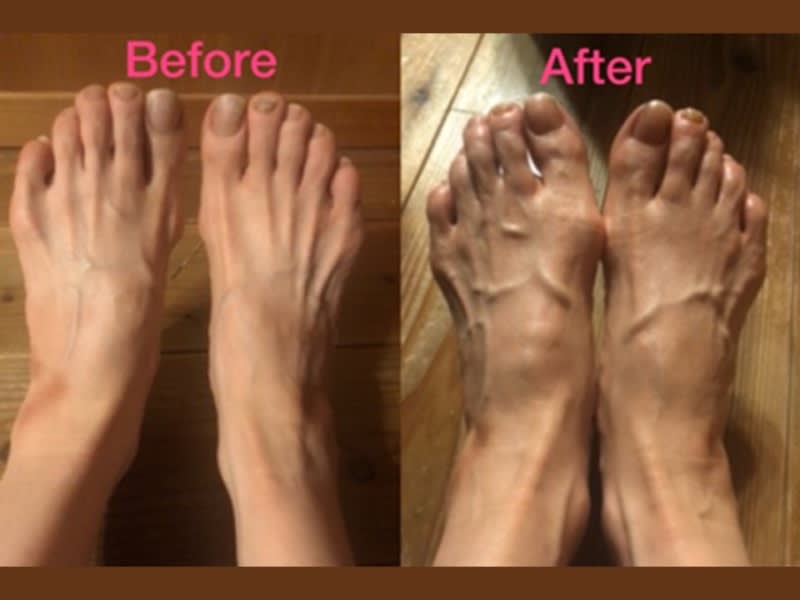 The foot changes drastically to another person's level!XNUMX weeks of actual monitor experience, where confidence in the way of life brought relief from constipation.