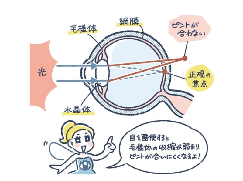 Increasing among young people!Check your “smartphone presbyopia” risk