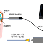 注射針レベルの極細ディスポーザブル内視鏡、慶應義塾大学が開発に成功