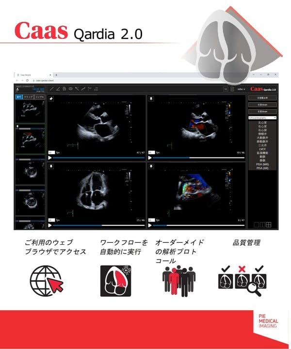 Pie Medical Imaging's revolutionary echocardiography software platform, C…