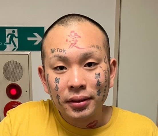 顔面ニキが顔面タトゥー除去手術を報告「俺の人生には必要ない入れ墨を消してきた」　額の「愛」も薄く