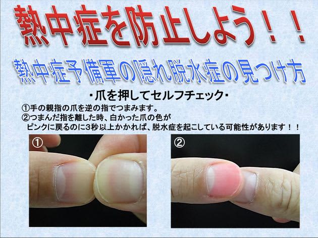 Beware of heatstroke, self-check for dehydration just press your fingernail.The method announced by the Ministry of Health, Labor and Welfare is simple and convenient
