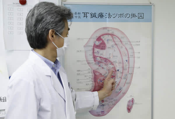 耳ツボとはどんなもの？ 「耳介療法」は米軍でも採用されている【東洋医学を正しく知って不調改善】