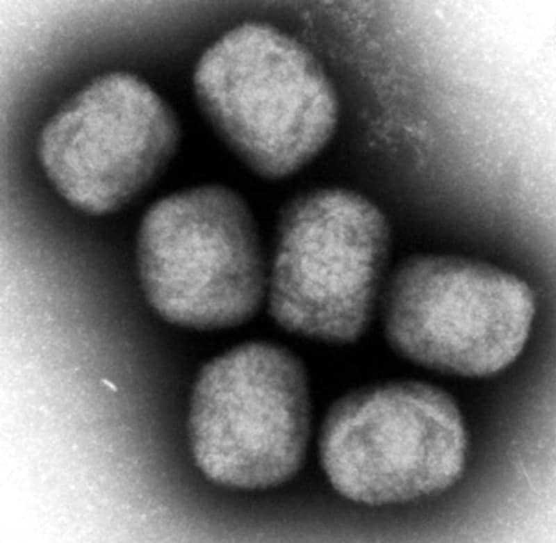 Monkeypox infection confirmed for the first time in Aichi, a man in his 40s with no travel history