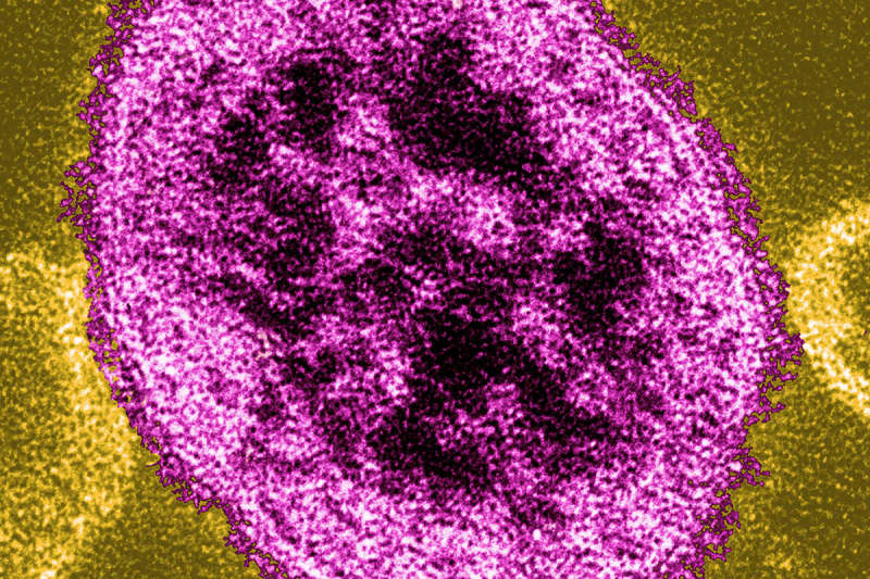 Be especially careful of those over 50... The fear of "measles" that causes pneumonia and encephalitis Confirmed infection in Kobe after Ibaraki and Tokyo!