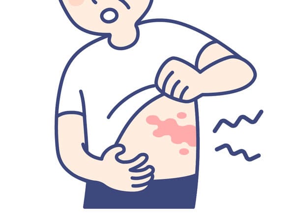 Let's know herpes zoster correctly
