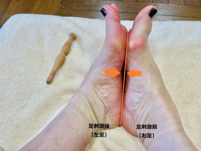 I love running marathons over 100km a month!But bunions are a problem...A foot stimulant that will keep your body in good shape starting from your feet…