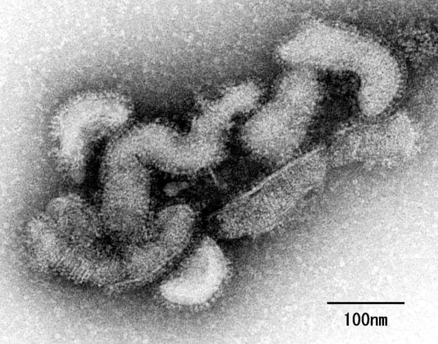 マダニ媒介の「オズウイルス感染症」で世界初の死亡例　日本で確認