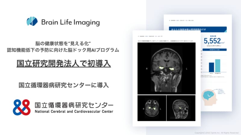 [First introduced by a national research and development agency] "Visualization" of brain health.Brain checkup A for prevention of cognitive decline…