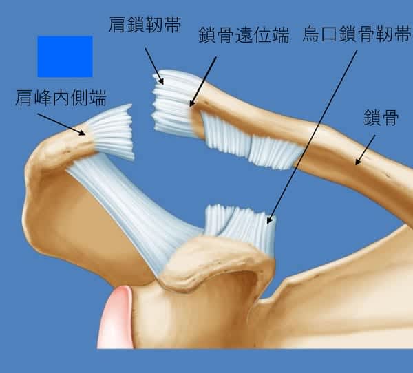“Shoulder “clavicle” joint dislocation” that often occurs in falls… What is the difference from shoulder joint dislocation? [Pain refreshing body easy chin]