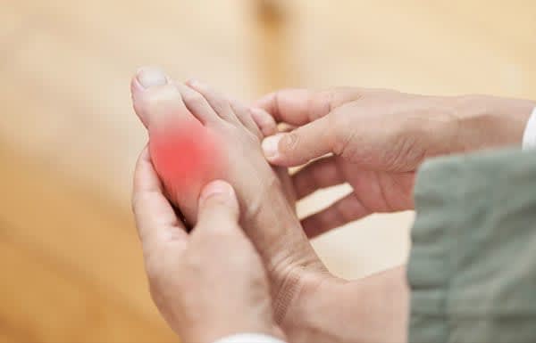 If you think it's gout... Strong big toe pain may be "strong big toe"