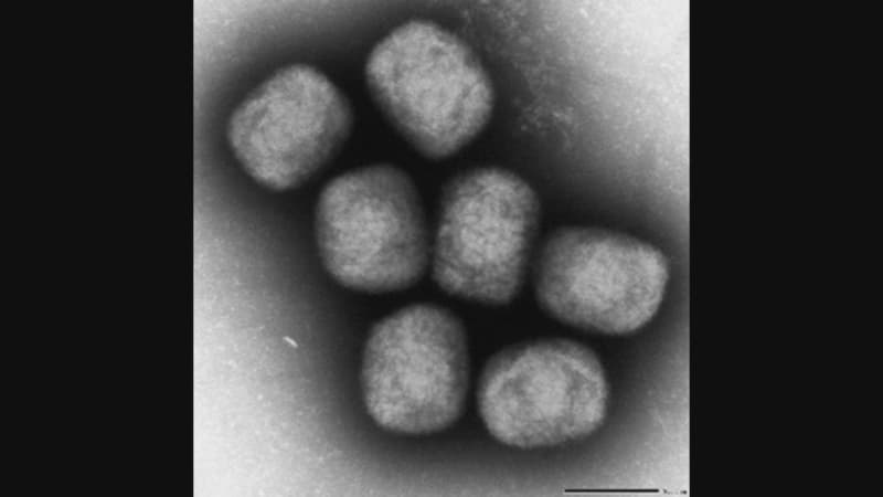 Empox, formerly known as "monkeypox" patient first confirmed Gunma Prefecture