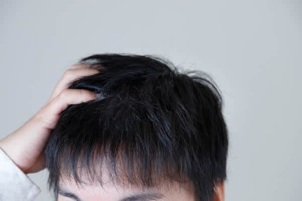 Is there a way to deal with "hair loss" and "hair growth" in oriental medicine?