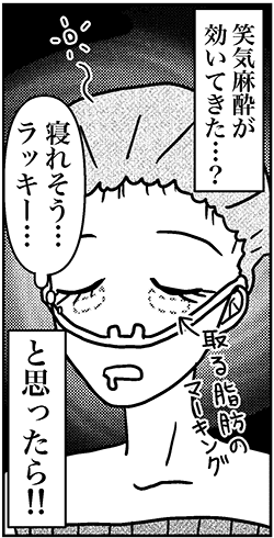 【アラフォー婚活ルポ】若見えのためクマ取りへ……私は痛みに強いのか？