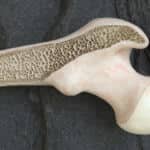 Osaka University and other researchers discovered that the bone matrix orientation structure of natural bone exhibits high resistance to bacterial infection.