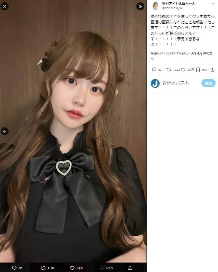 ``This is the reality of plastic surgery!'' An idol who has had plastic surgery for 1300 million yen complains, and also posts before and after facials...