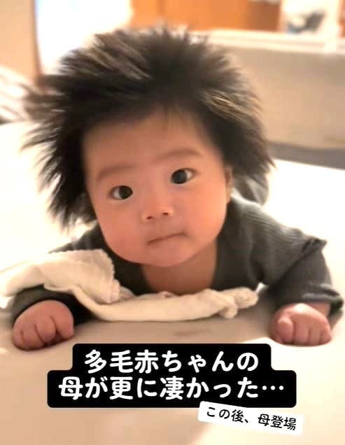 A baby with fluffy hair at 3 months old...but mom is even more excited! ``It's overwhelmingly genetic'' ``My mom is brave...''