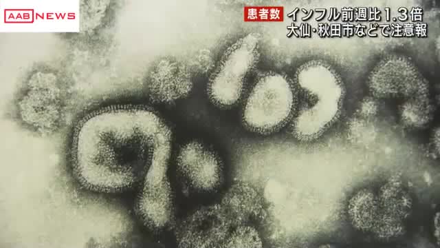 インフルエンザ　秋田県は前の週から患者数が１．３倍に増加